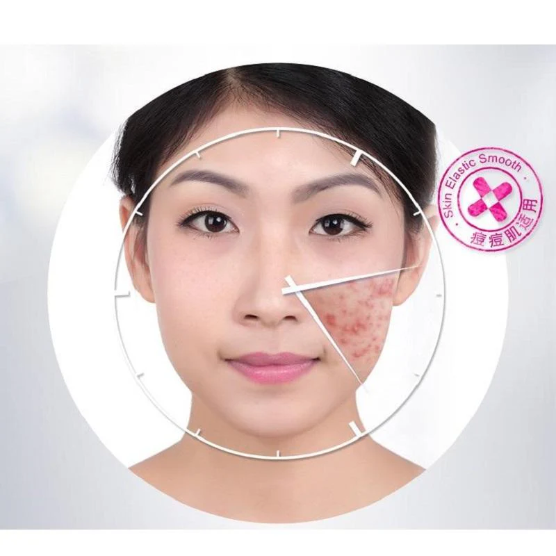BIOAQUA Anti-Acne & Rejuvenating Cream - Acne Care 30g - Image 5