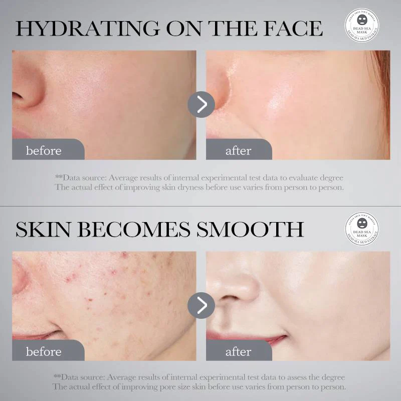 Bioaqua Dead Sea Mud Whitening Mud Mask 8g*10 Pcs - Image 4