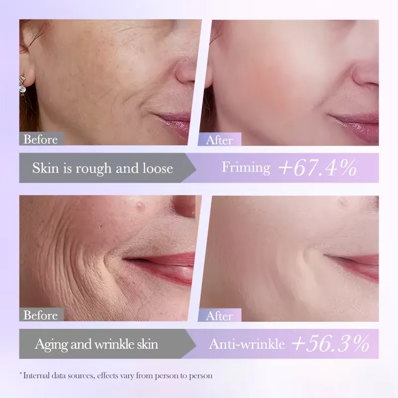 BIOAQUA Hyaluronic Acid + Vitamin A Firming & Nourishing Face Sheet Mask - Image 5