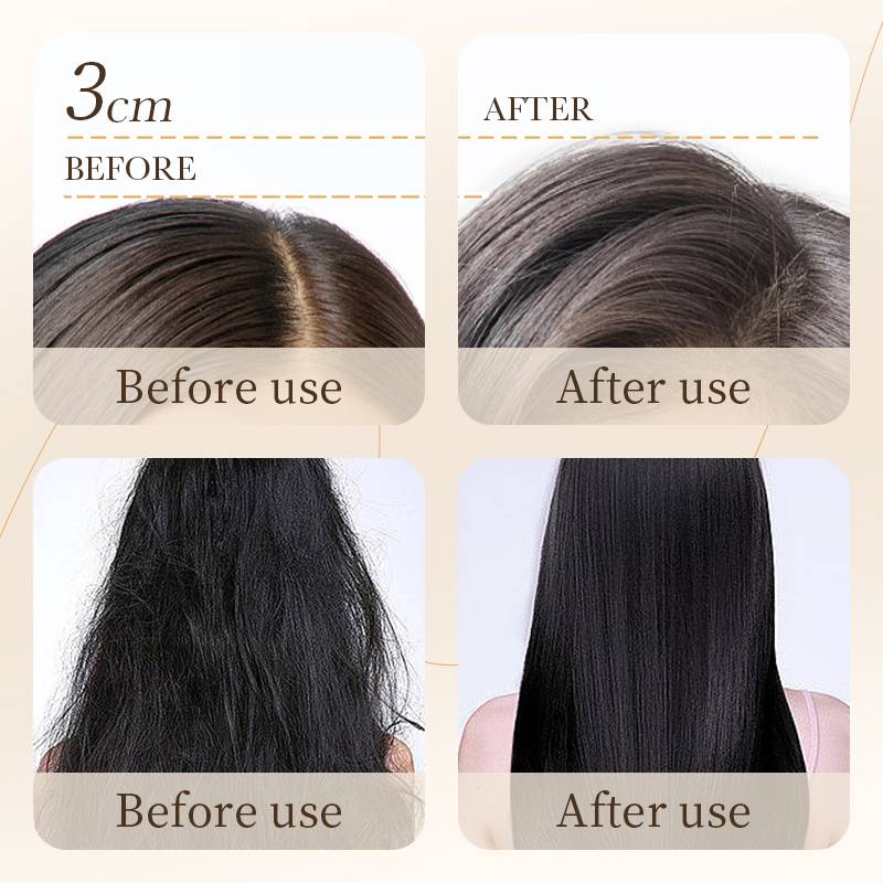 BIOAQUA Rice Shampoo - Anti-Dandruff & Oil Control Shampoo - 500ml - Image 6