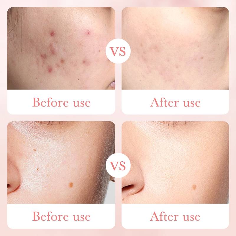 Bioaqua Rose Hyaluronic Acid Oil Control Moisturizing Facial Cleanser  - 100g - Image 5