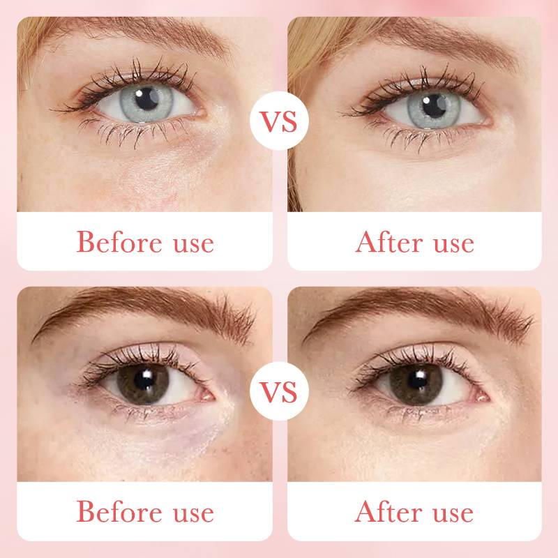 BIOAQUA Rose Hyaluronic Acid Moisturizing Eye Mask 30 Pairs 80g - Image 5