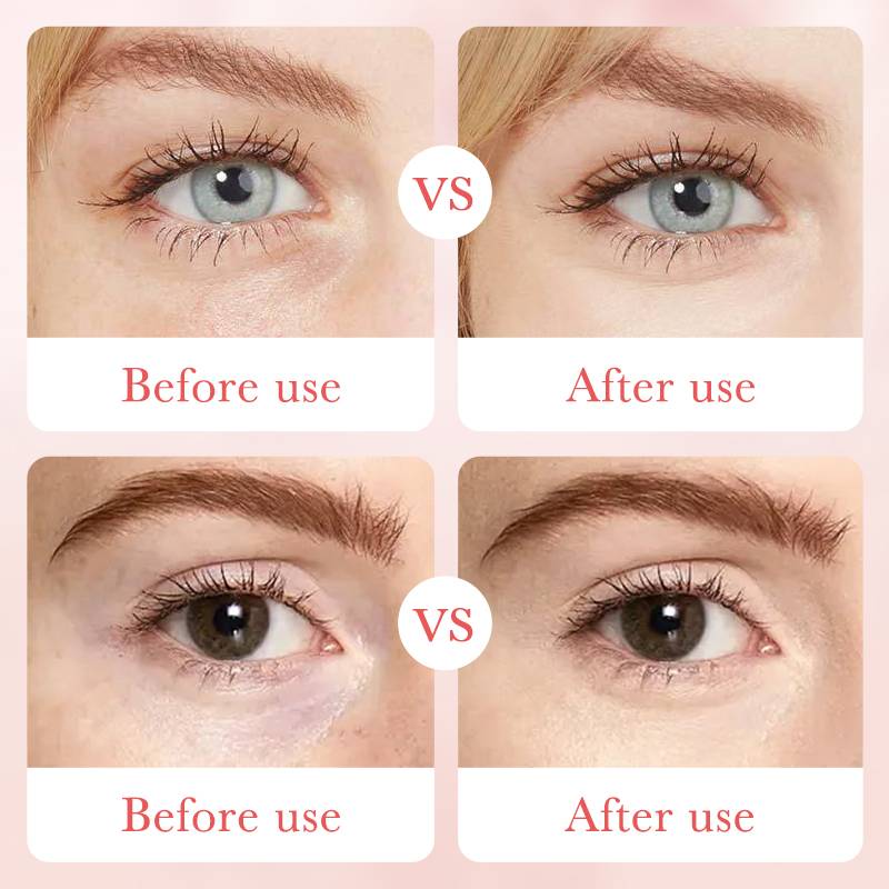 BIOAQUA Rose Eye Cream - Hyaluronic Acid Moisturizing Eye Care - 20g - Image 7