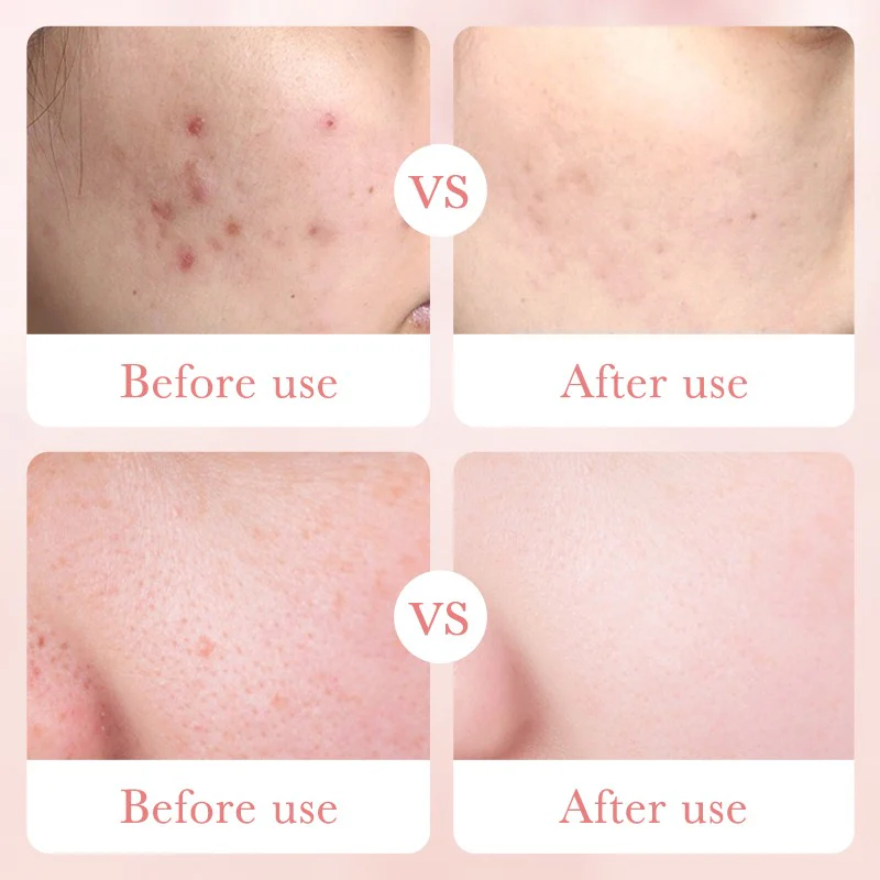 Bioaqua Rose Hyaluronic Acid Moisturizing Anti Aging Face Lotion 100ml - Image 7
