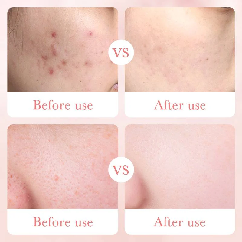 Bioaqua Rose Hyaluronic Acid Moisturizing Nourishing Toner 100ml - Image 5