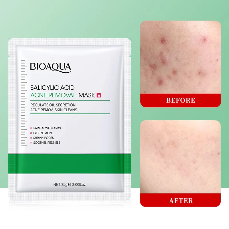 BIOAQUA Salicylic Acid Acne Removal Facial Sheet Mask - Image 3
