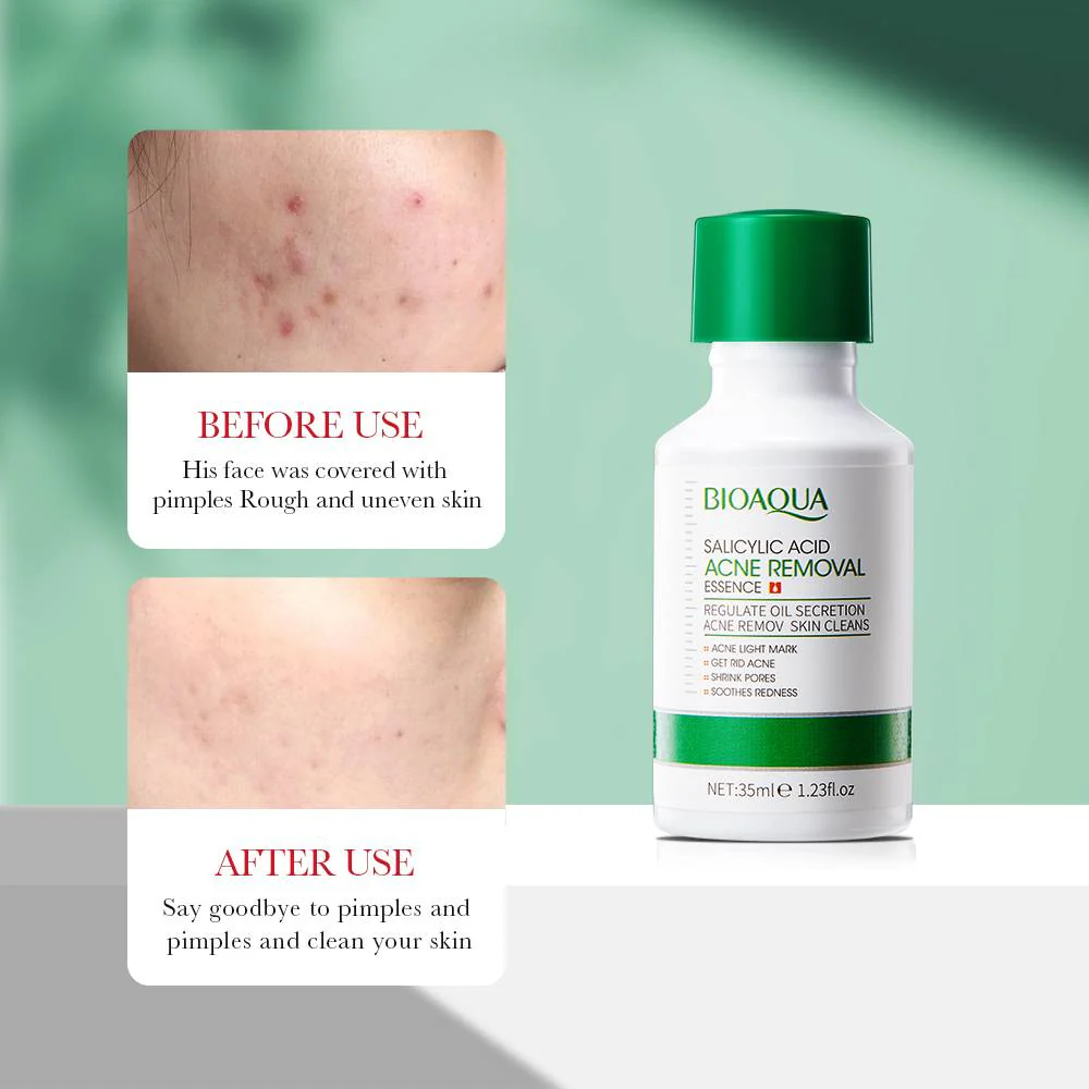 BIOAQUA Salicylic Acid Acne Removal Essence Serum 35ml - Image 3