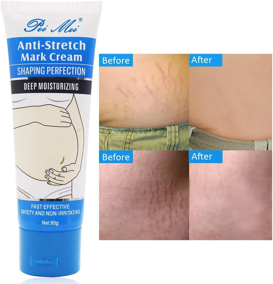 Guanjing Stretch Mark Remover Anti Stretch Mark Cream 80gm - Image 2
