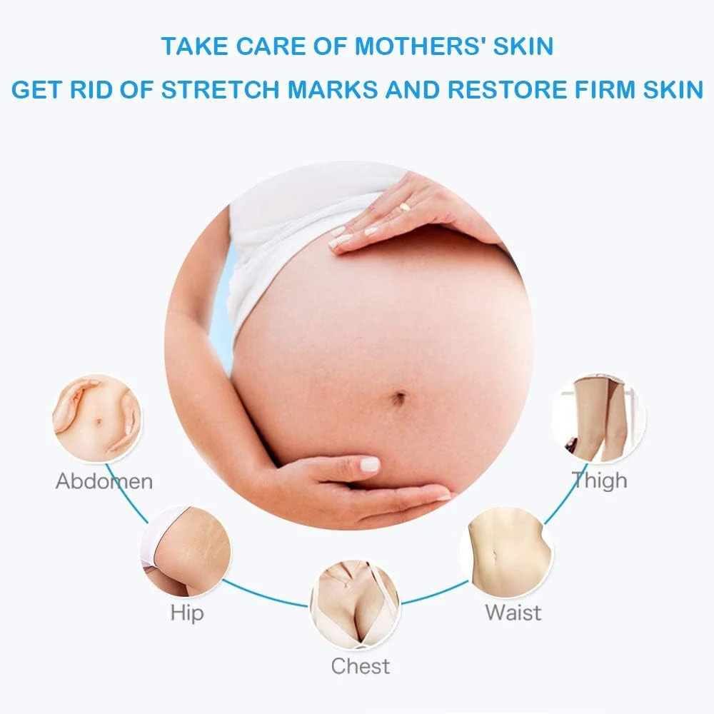 Guanjing Stretch Mark Remover Anti Stretch Mark Cream 80gm - Image 3