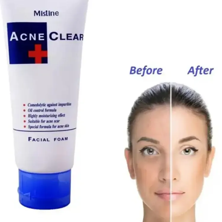 Pack of 2 Mistine Acne Clear Facial Foam and Bioaqua Acne Cream - Image 3