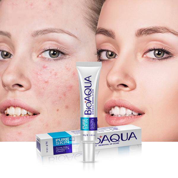 Pack of 2 Mistine Acne Clear Facial Foam and Bioaqua Acne Cream - Image 4