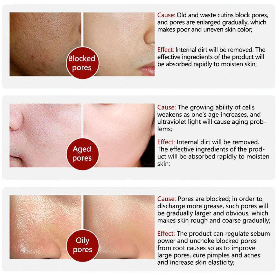 ROREC White Rice Serum - Moisturizing & Pore Refining Essence - 15ml - Image 4