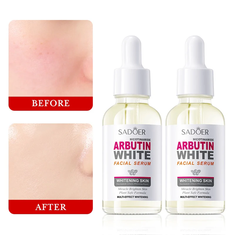 SADOER Arbutin Nicotinamide Serum - Brightening & Moisturizing - 30ml - Image 3