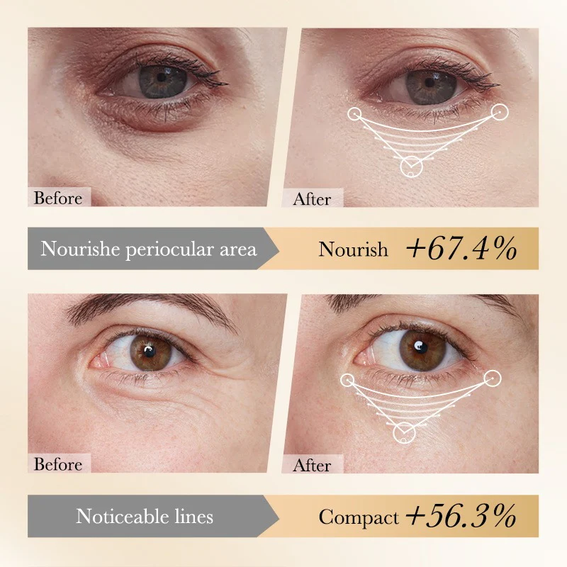 SADOER Collagen Anti-Aging Eye Mask to Remove Dark Circles - Image 5