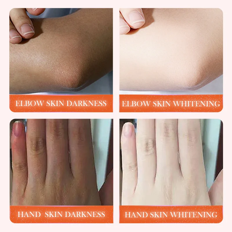 SADOER Dark Knuckle Brightening Niacinamide Vitamin C Body Serum 50ml - Image 6