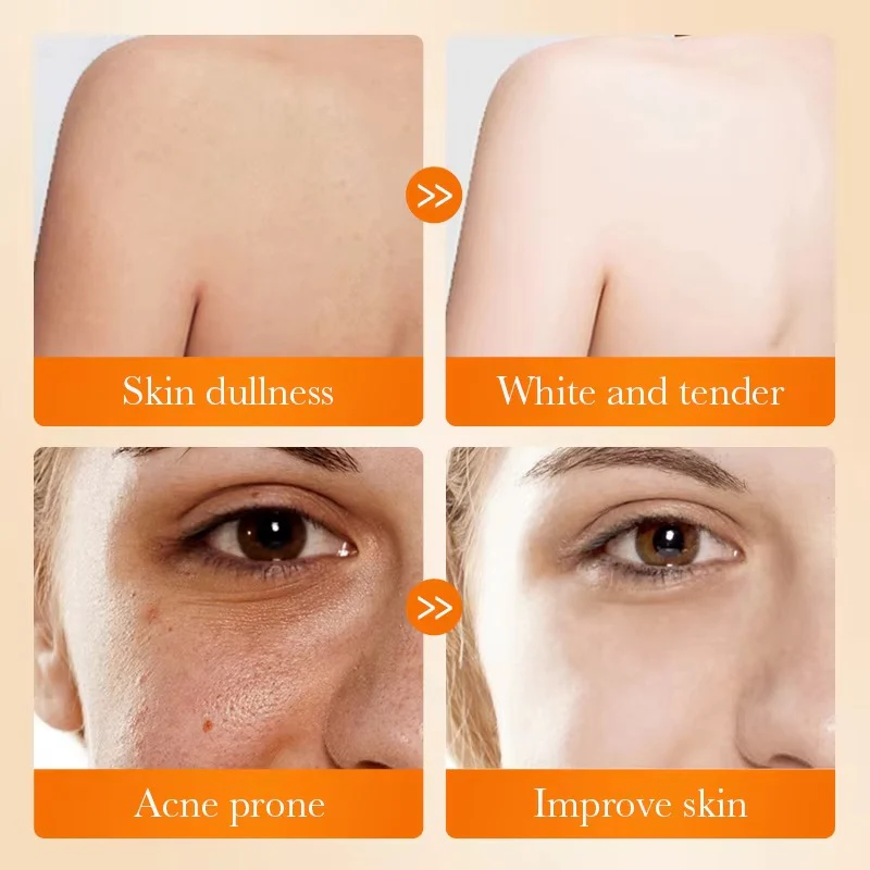 Sadoer Kojic Acid Brightening Soap - 100g - Image 3