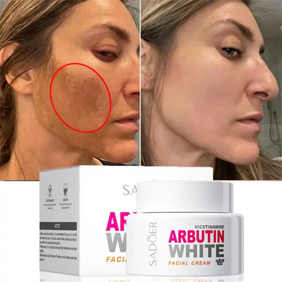 SADOER Nicotinamide Arbutin White Facial Cream 50g - Image 4