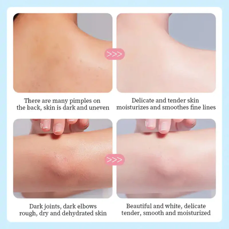 SADOER Rose Body Butter Lotion – Moisturizing & Brightening Body Cream 200g - Image 5