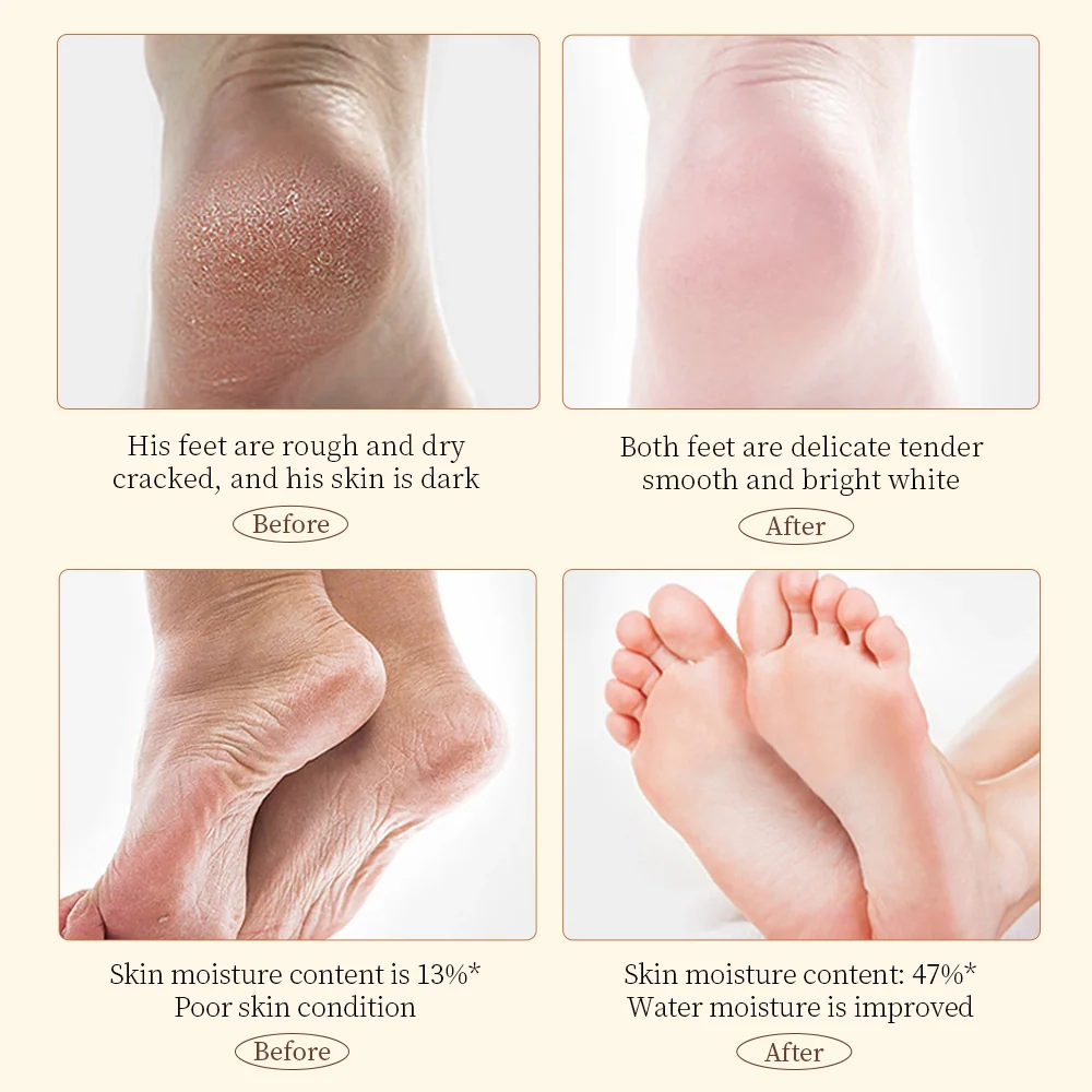 SADOER Shea Butter Anti-Cracking Hand Foot Cream 60gm - Image 5