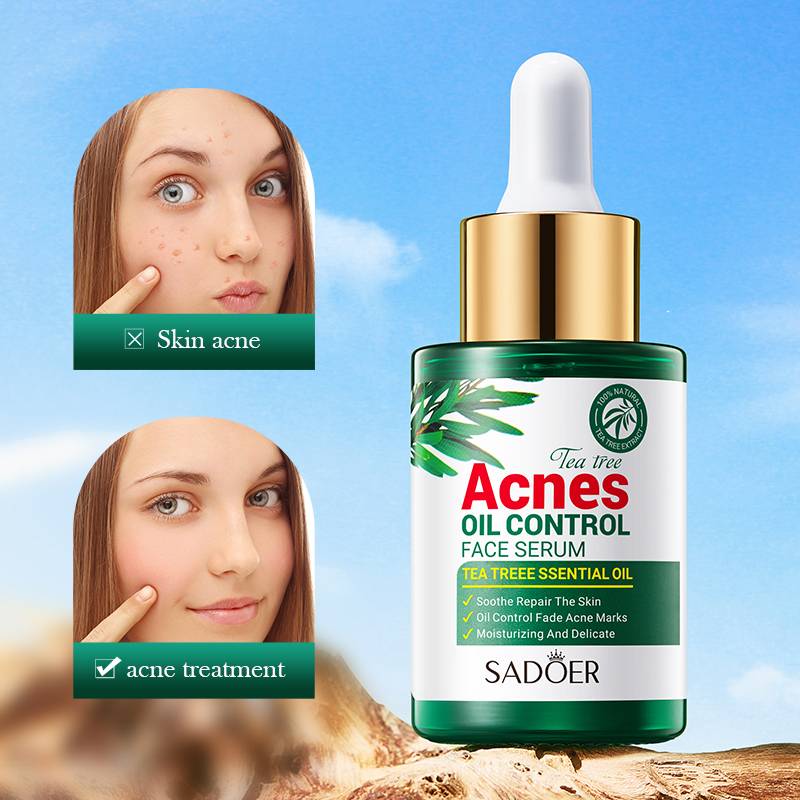 SADOER Tea Tree Serum - Oil Control & Anti-Acne Face Serum - 30ml - Image 5