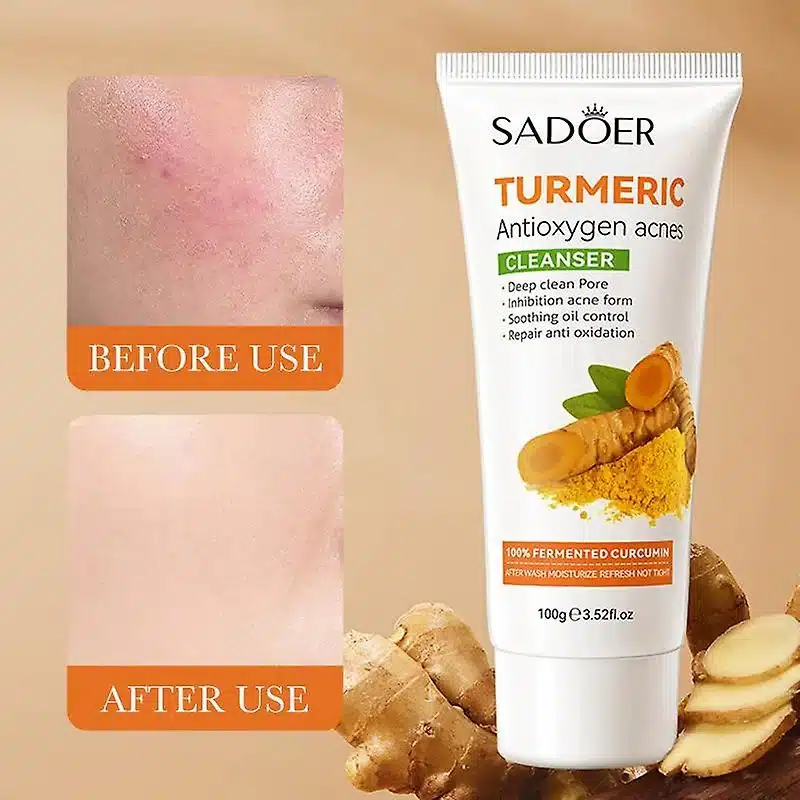 SADOER Turmeric Acne Facial Cleanser - 100g - Image 4