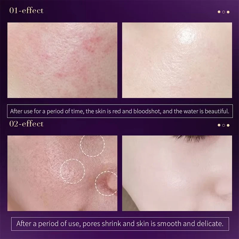 SUSU Wish Nicotinamide Bright Ampoule Essence Set Box - Image 7