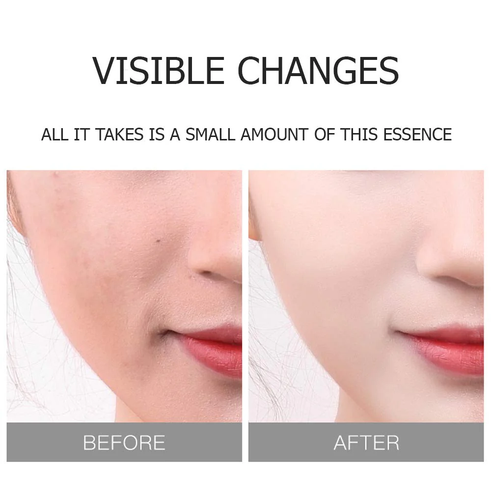 VEZE Gold Hyaluronic Acid Hydrating Face Sheet Mask 25g - Image 4