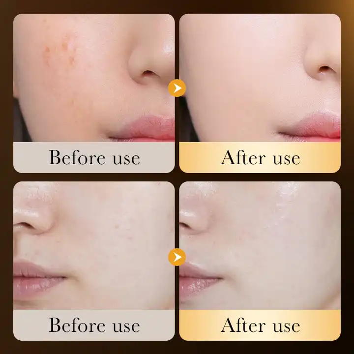 ZOZU 24K Gold Serum - Hyaluronic Acid Moist Repair Essence - 30ml - Image 5